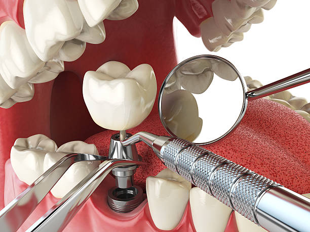 Dentist for Dental Trauma in VA