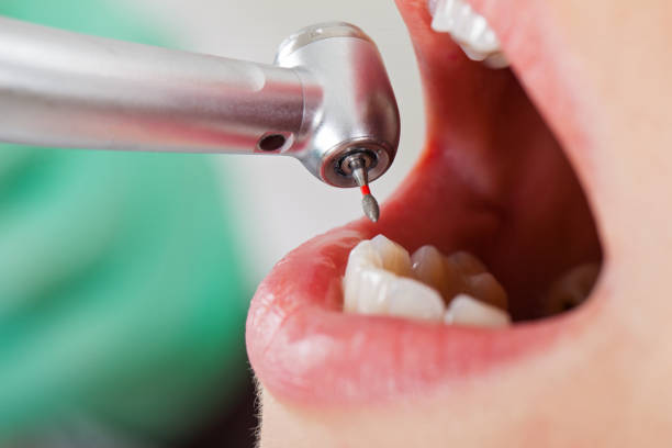 Best Broken Tooth Emergency  in Mechanicsville, VA